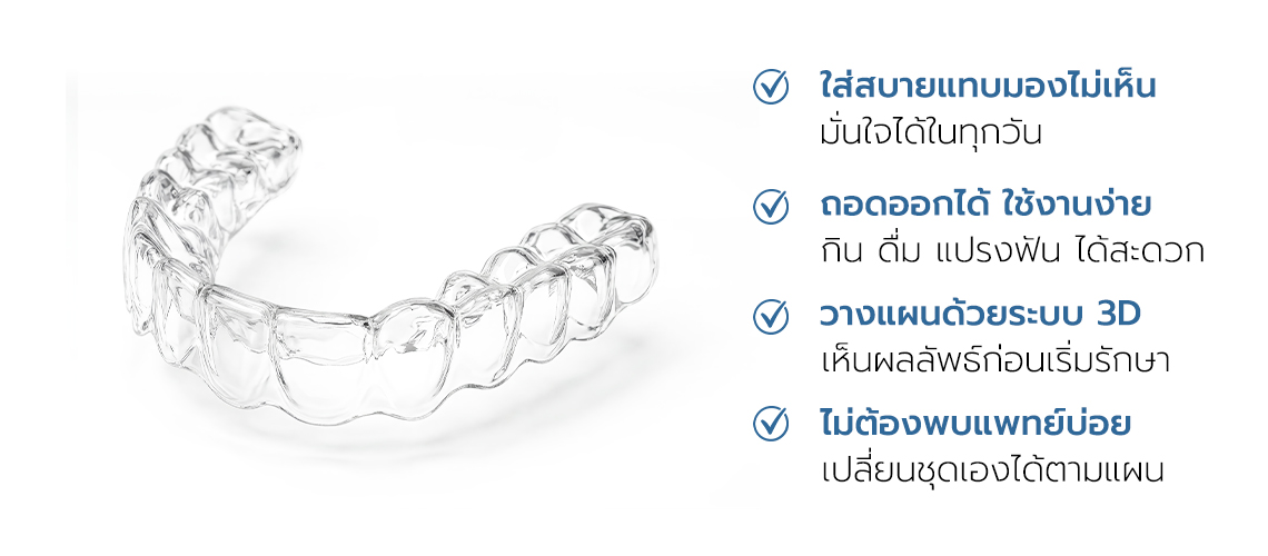 จัดฟันใส Clear Aligner: ใส่สบายแทบมองไม่เห็น ถอดออกได้ใช้งานง่าย วางแผนด้วยระบบ 3D ไม่ต้องเข้าคลินิกบ่อย